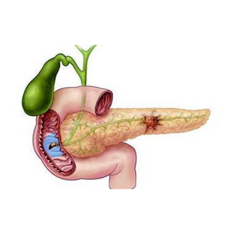 췌장 품목